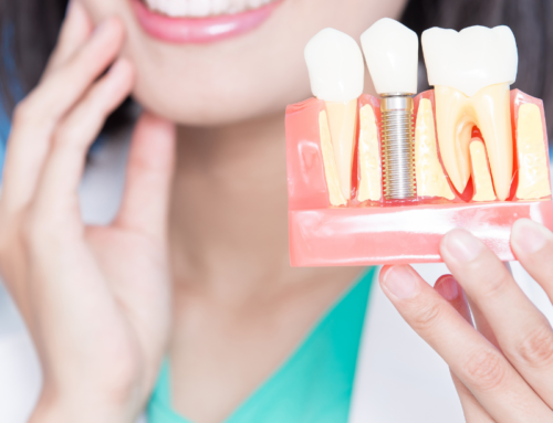 Implante dental: la mejor forma de reponer un diente perdido